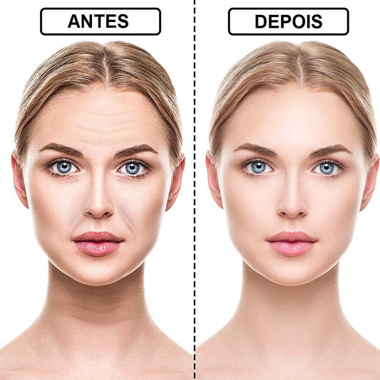 Silicone Anti-Wrinkle and Expression Lines Sticker